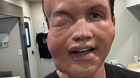 US-Schauspieler Rob McElhenney ist kaum wiederzuerkennen.
