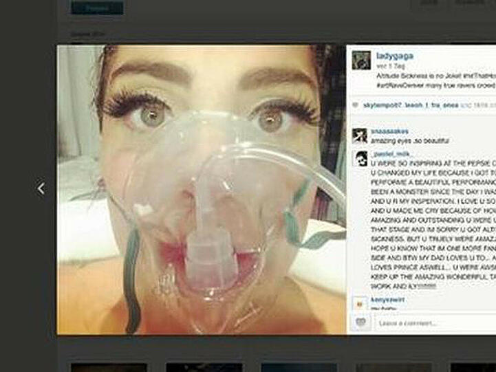Lady Gaga ließ sich wegen Höhenkrankheit behandeln