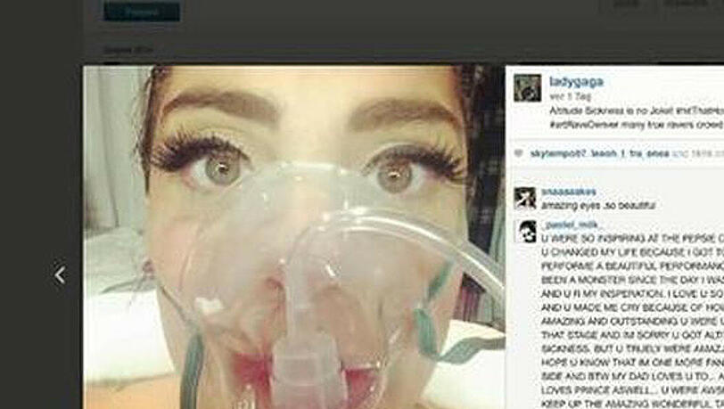 Lady Gaga ließ sich wegen Höhenkrankheit behandeln Lady Gaga ließ sich wegen Höhenkrankheit behandeln