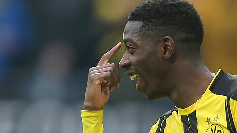 Bei solchen Summen kann man sich schon mal ans Hirn langen. Ousmane Dembélé wird der teuerste Bundesliga-Transfer aller Zeiten.