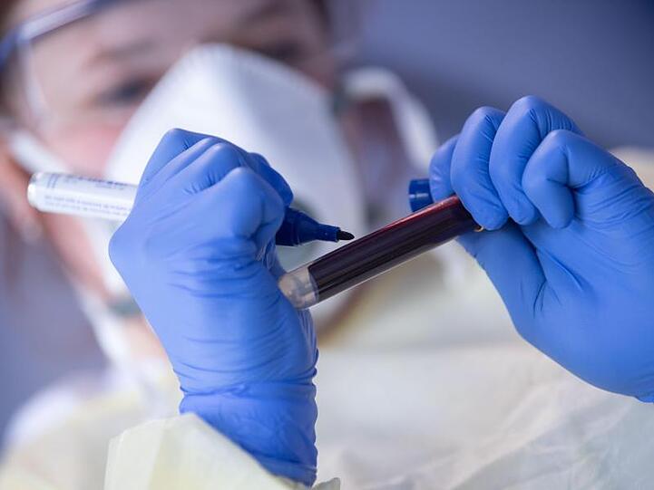 Ein Mitarbeiterin des Robert Koch-Instituts (RKI) beschriftet eine Blutprobe.