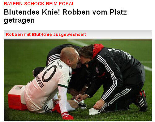 Beim Kölner "Express" dreht es sich um den "Bayern-Schock" durch die Verletzung von Arjen Robben.