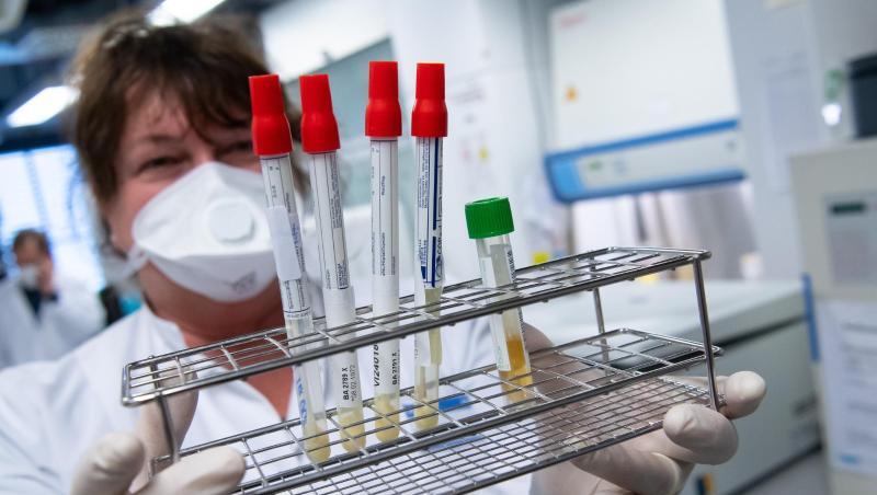 Eine Laborantin führt Untersuchungen zum Coronavirus durch. Foto: Sven Hoppe/dpa/Symbolbild Eine Laborantin führt Untersuchungen zum Coronavirus durch. Foto: Sven Hoppe/dpa/Symbolbild