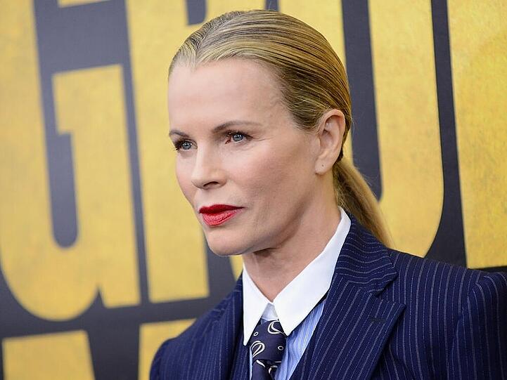 Angst vor dem Altern? Kim Basinger sagt den Falten den Kampf an