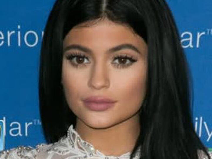 Kylie Jenners Gesicht wirkt wie eine Maske