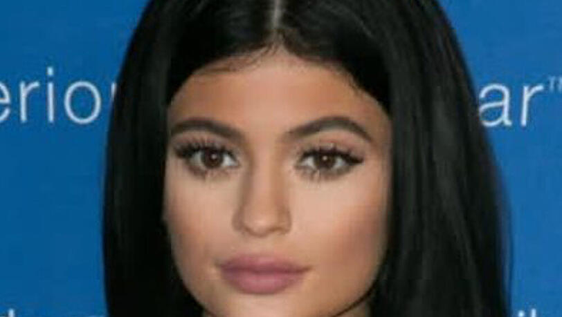 Kylie Jenners Gesicht wirkt wie eine Maske Kylie Jenners Gesicht wirkt wie eine Maske