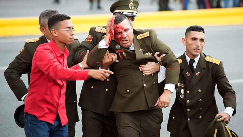 Ein Soldat blutet am Kopf, nachdem es bei einer Militärparade in Venezuela einen versuchten Anschlag gegen Staatschef Nicolas Maduro gegeben hat.