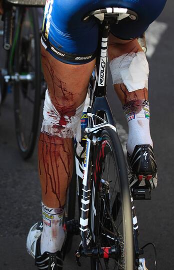 Tour der Leiden: Eine Sturzserie überschattet die Frankreich-Rundfahrt 2011. Die Bilder.