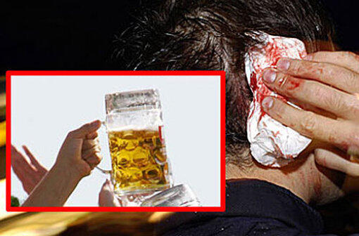 Attacke mit einem Maßkrug