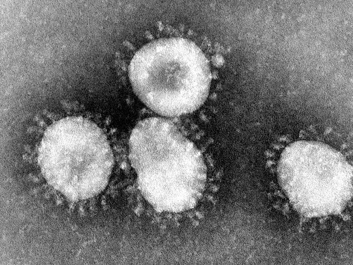 Ein Coronavirus unter dem Mikroskop. Foto: Center for Disease Control/epa/dpa/Archivbild