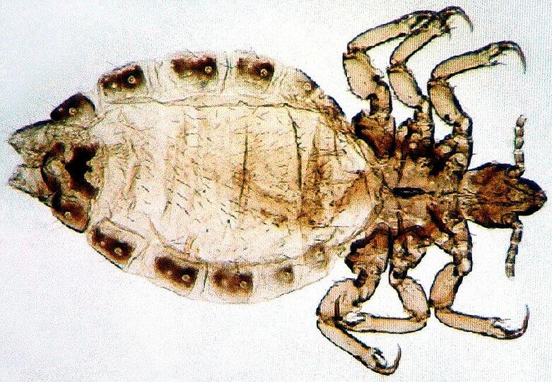 Fieses Tierchen: So sieht eine Kopflaus stark vergrößert aus.