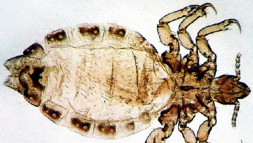 Fieses Tierchen: So sieht eine Kopflaus stark vergrößert aus. Fieses Tierchen: So sieht eine Kopflaus stark vergrößert aus.