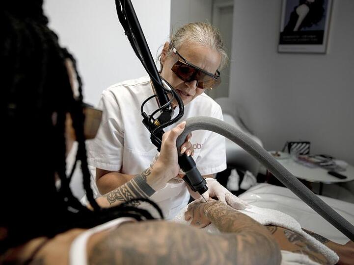 Petra Lichtblau entfernt per Laser ein Tattoo.