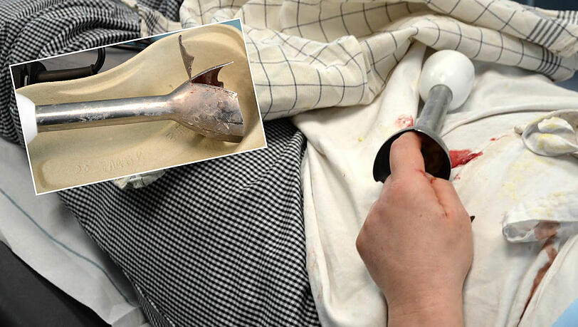 Die Feuerwehr musste den Finger im Mixer versorgen. Die Feuerwehr musste den Finger im Mixer versorgen.