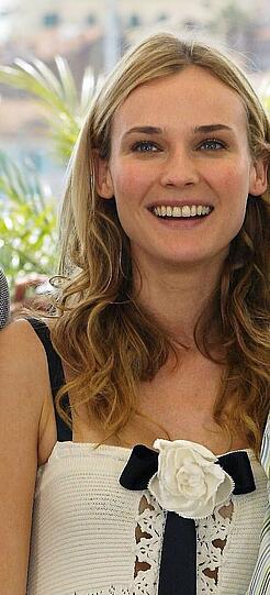 Auch Diane Kruger war beim Bleachen und hat jetzt hellere Zähne...