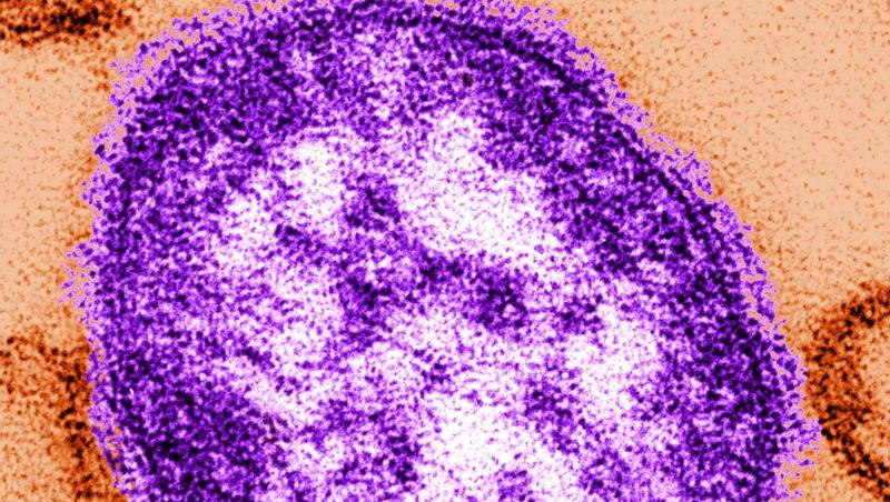 Teile eines Masernvirus: Mit Abstand am schwersten betroffen war die Ukraine mit mehr als 53.000 Fällen. Teile eines Masernvirus: Mit Abstand am schwersten betroffen war die Ukraine mit mehr als 53.000 Fällen.