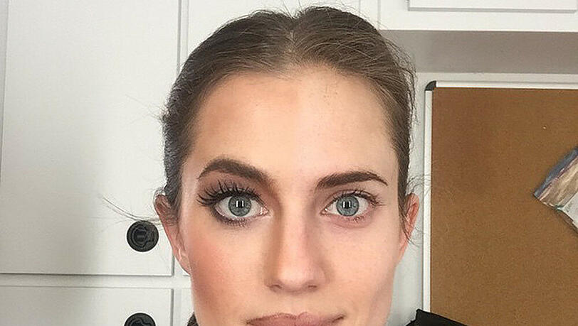 Allison Williams zeigt vorher und nachher in einem Bild Allison Williams zeigt vorher und nachher in einem Bild