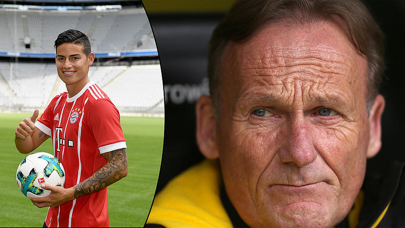 Hans-Joachim Watzke über den Vorsprung des FC Bayern und die Verpflichtung von James Rodriguez