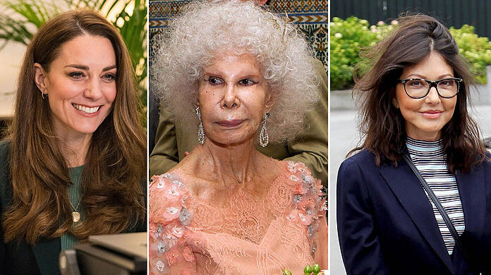 Heimliche Beauty-OPs der Royals: Wer lag schon unterm Messer?