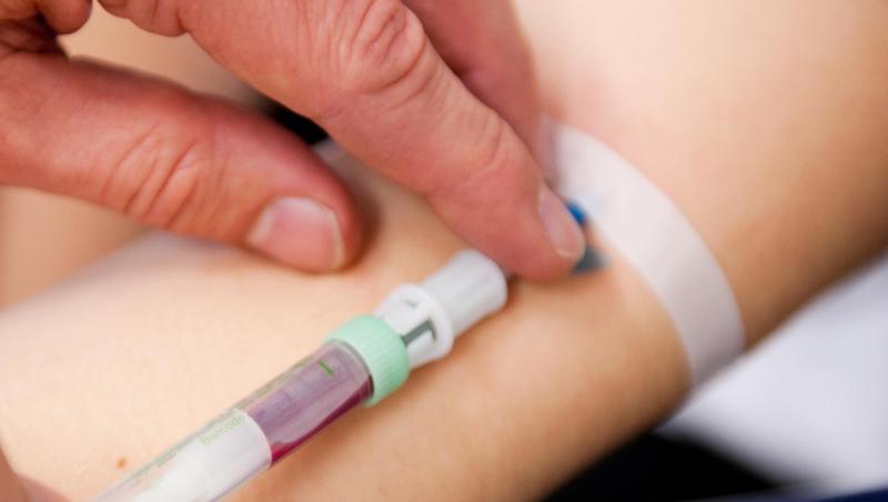 Eine Frau bekommt in einer Klinik Blut abgenommen. Eine Frau bekommt in einer Klinik Blut abgenommen.