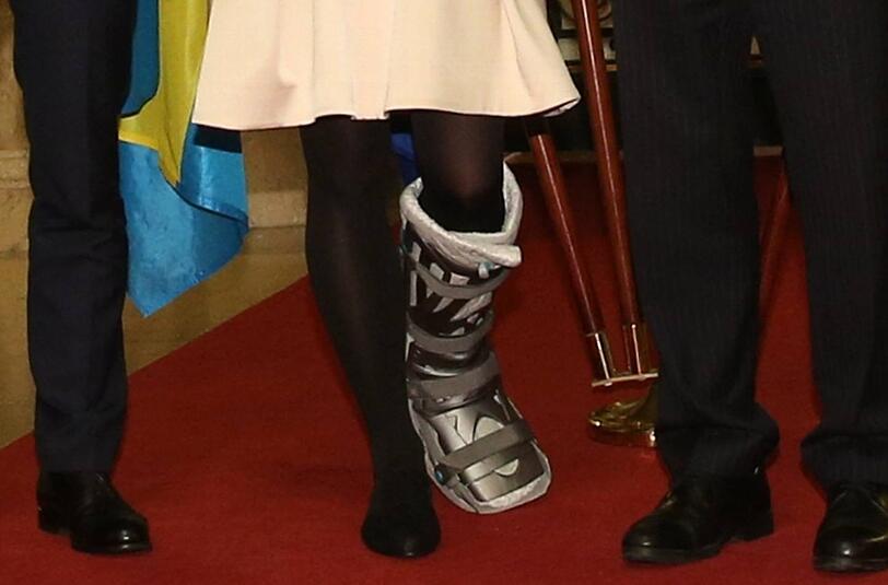 Farblich passte die Schiene gar nicht schlecht zum restlichen Outfit.
