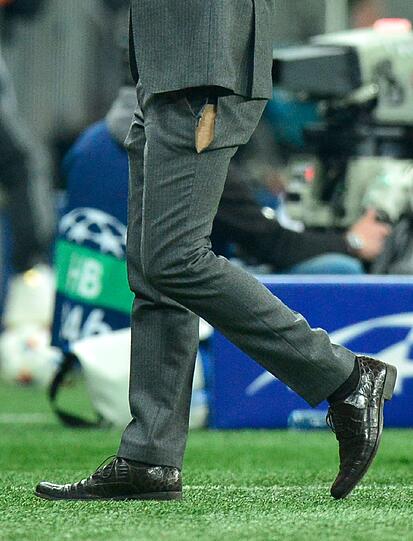 Vor Anspannung zerissen: Die Hose von Pep Guardiola.