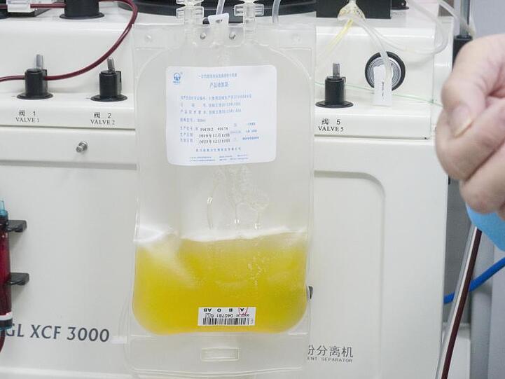 Gespendetes Plasma eines geheilten Coronavirus-Patienten wird in einem Plasmabeutel aufgefangen. Foto: Cai Yang/XinHua/dpa/Symbolbild