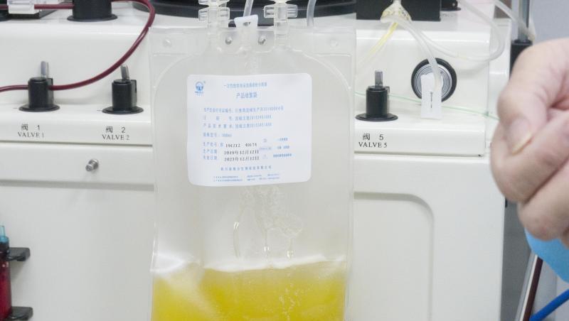 Gespendetes Plasma eines geheilten Coronavirus-Patienten wird in einem Plasmabeutel aufgefangen. Foto: Cai Yang/XinHua/dpa/Symbolbild Gespendetes Plasma eines geheilten Coronavirus-Patienten wird in einem Plasmabeutel aufgefangen. Foto: Cai Yang/XinHua/dpa/Symbolbild
