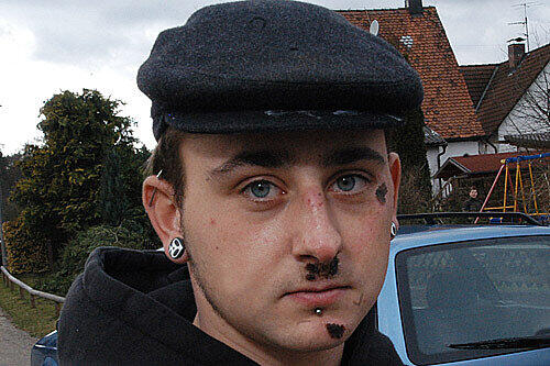 So sah Matthias H. wenige Tage nach der Taxi-Attacke aus.