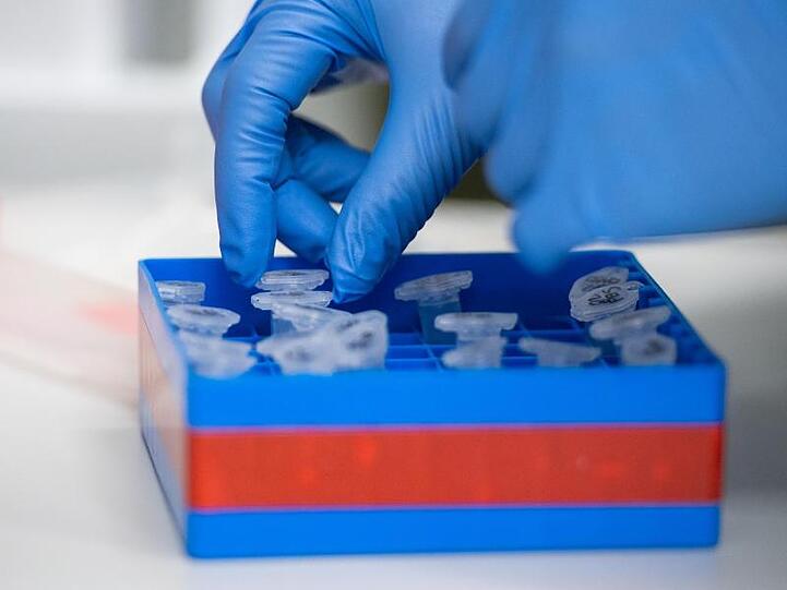 Eine Laborantin führt Untersuchungen zum Coronavirus durch. Foto: Christophe Gateau/dpa/Symbolbild