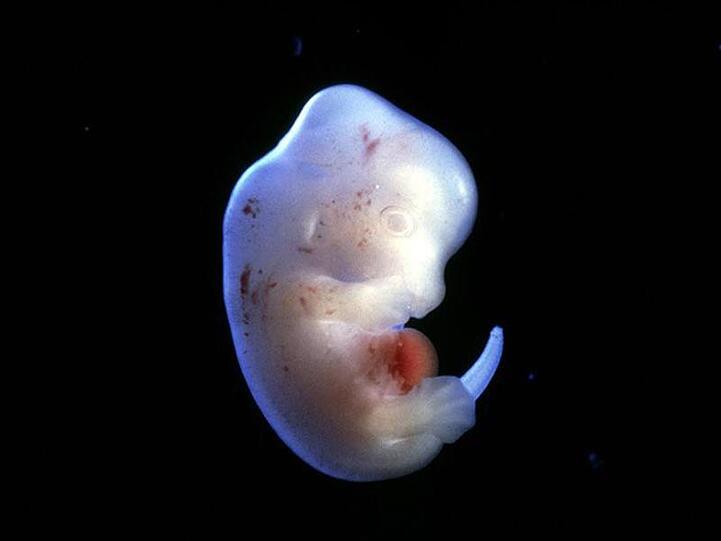 Japanische Forscher wollen menschliche Organe in Tieren züchten - wie etwa in einem Rattenembryo.