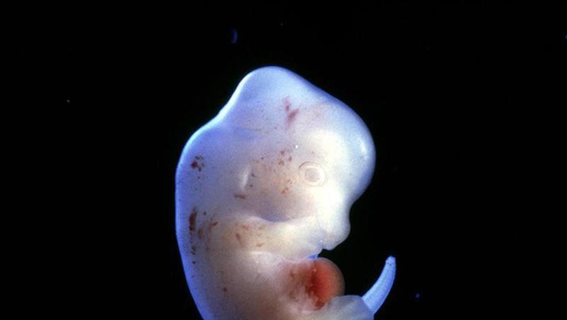 Japanische Forscher wollen menschliche Organe in Tieren züchten - wie etwa in einem Rattenembryo. Japanische Forscher wollen menschliche Organe in Tieren züchten - wie etwa in einem Rattenembryo.