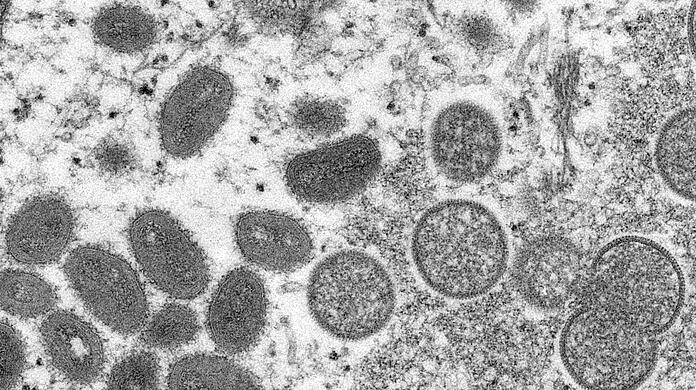 Reife, ovale Affenpockenviren (l) und kugelförmige unreife Virionen (r) aus einer menschlichen Hautprobe: Fälle der eigentlich seltenen Affenpocken werden mittlerweile in immer mehr Ländern nachgewiesen .
