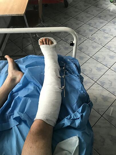 Ein Stück der Wade ist herausgerissen, daneben hat sich Bauer mehrere Knochen gebrochen.