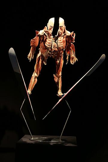 Bei diesem Skispringer sind einige Muskeln und Sehnen von den Knochen des Körpers abgelöst.