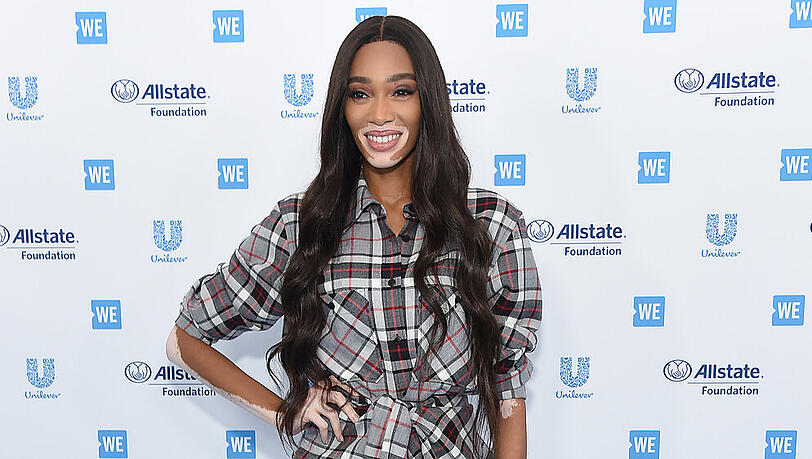 Winnie Harlow hat ihre Beziehung zu Kyle Kuzma öffentlich gemacht. Winnie Harlow hat ihre Beziehung zu Kyle Kuzma öffentlich gemacht.