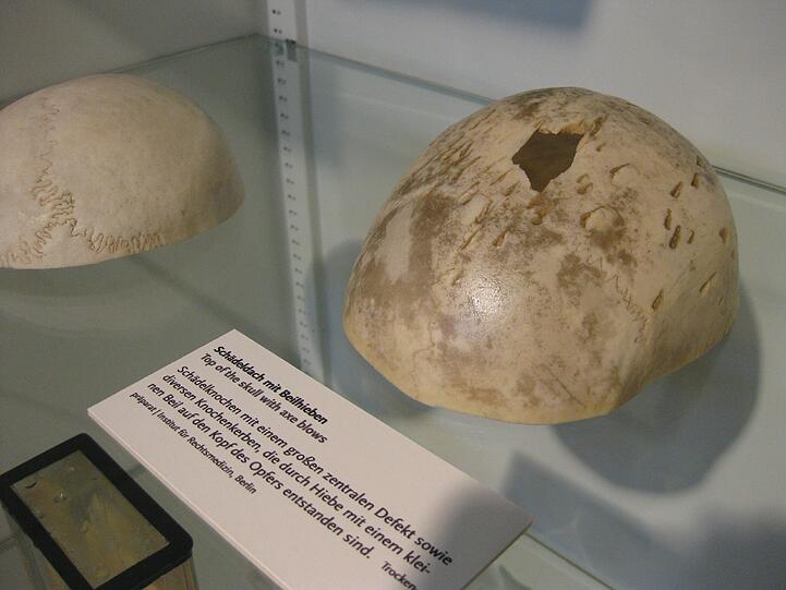Schädel mit Loch durch Beilhieb