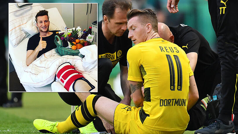 Daumen, hoch nach überstandener Keruzband-OP: Dennoch muss Marco Reus nach seiner Verletzung im Pokalfinale lange die Füße stillhalten.