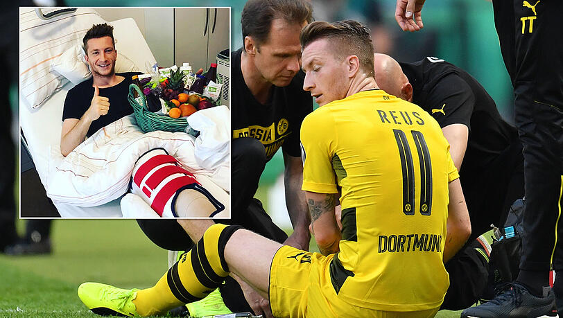 Daumen, hoch nach überstandener Keruzband-OP: Dennoch muss Marco Reus nach seiner Verletzung im Pokalfinale lange die Füße stillhalten. Daumen, hoch nach überstandener Keruzband-OP: Dennoch muss Marco Reus nach seiner Verletzung im Pokalfinale lange die Füße stillhalten.