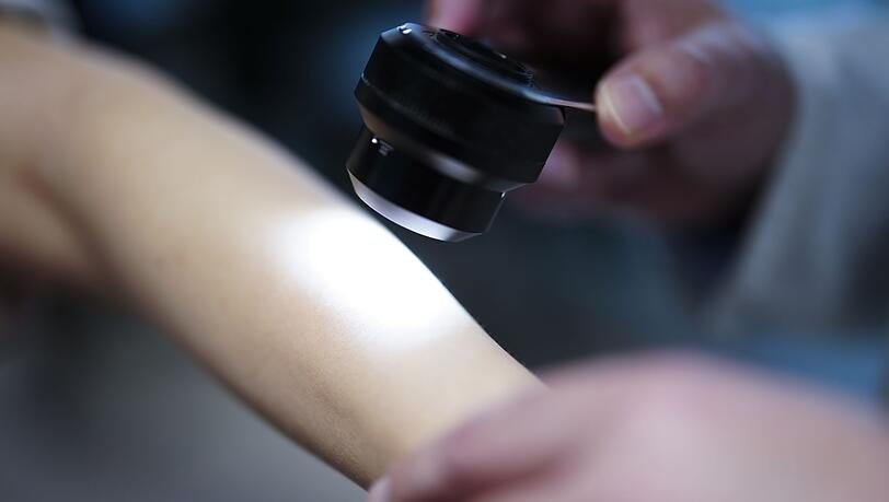 Nicht nur Hautkrebs l&auml;sst sich bei entsprechenden Vorsorgeuntersuchungen fr&uuml;hzeitig erkennen - und dann oft gut behandeln. (Symbolbild)