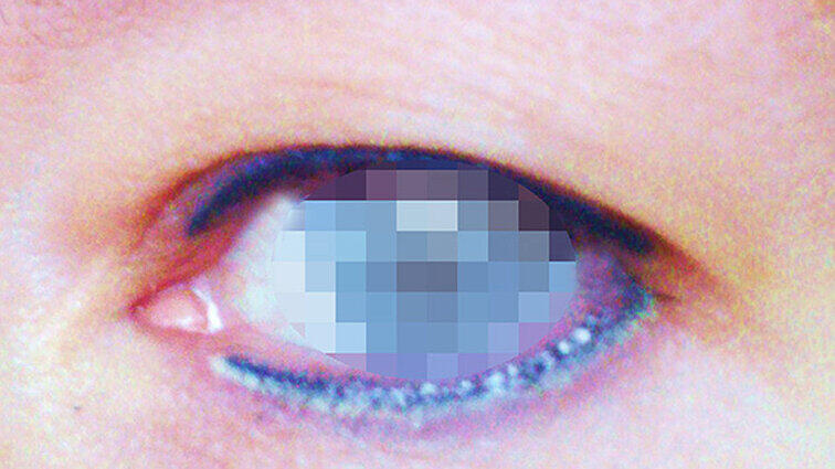 Bei Permanent Make-Up bleibt der Lidstrich dauerhaft - im Fall der Klägerin war dieser fehlerhaft.
