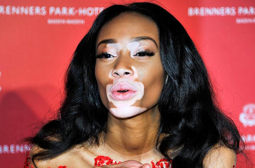 Chantelle Winnie