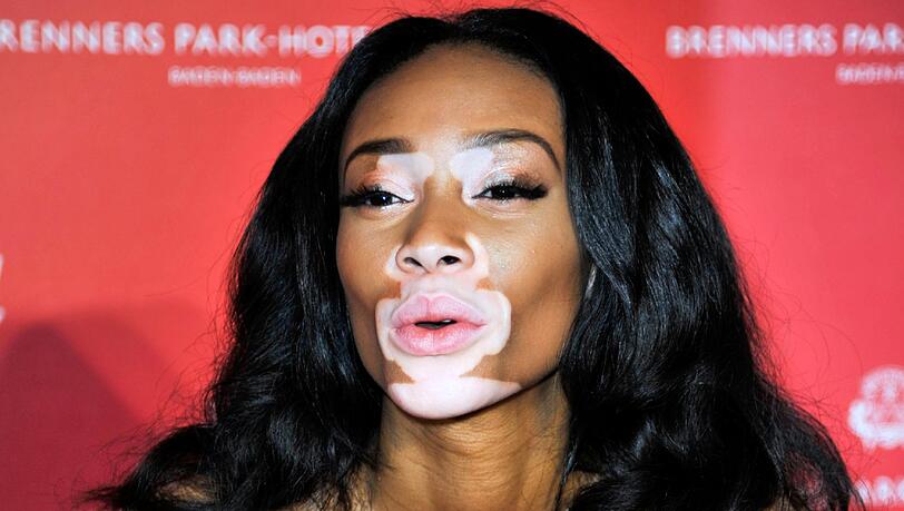 Chantelle Winnie Chantelle Winnie