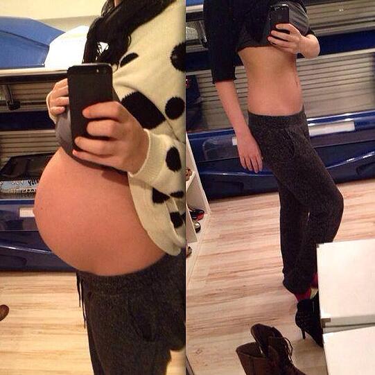 Vorher-Nachher: Sara Kulka mit Babybauch und ohne