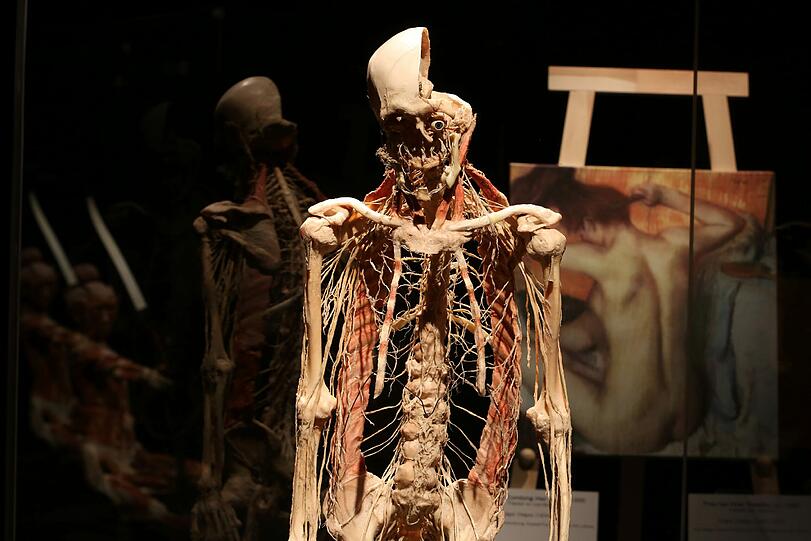 Bei diesem Ausstellungsstück werden die Nerven des menschlichen Körpers gezeigt.