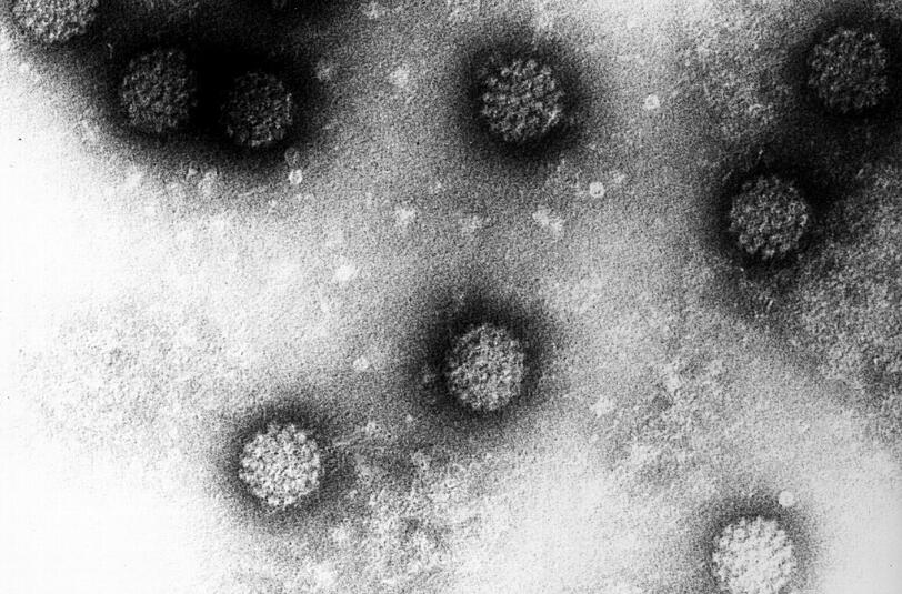 Das Foto zeigt eine Elektronenmikroskopische Aufnahme mehrerer Humaner Papillomviren (HPV. Im Fall von Gebärmutterhalskrebs wird seit 2007 die Möglichkeit der vorbeugenden Impfung gegen humane Papillomviren (HPV) für alle Mädchen zwischen 12 und 17 Jahren von der ständigen Impfkommission Deutschland empfohlen.
