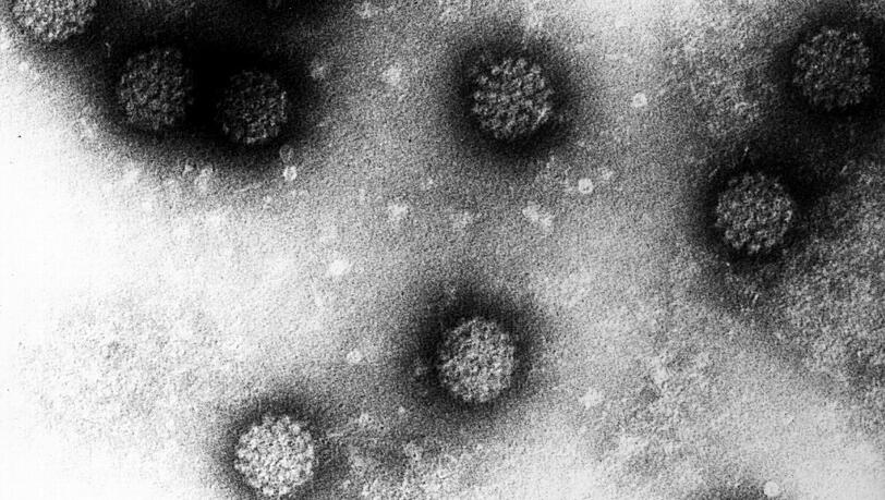 Das Foto zeigt eine Elektronenmikroskopische Aufnahme mehrerer Humaner Papillomviren (HPV. Im Fall von Gebärmutterhalskrebs wird seit 2007 die Möglichkeit der vorbeugenden Impfung gegen humane Papillomviren (HPV) für alle Mädchen zwischen 12 und 17 Jahren von der ständigen Impfkommission Deutschland empfohlen. Das Foto zeigt eine Elektronenmikroskopische Aufnahme mehrerer Humaner Papillomviren (HPV. Im Fall von Gebärmutterhalskrebs wird seit 2007 die Möglichkeit der vorbeugenden Impfung gegen humane Papillomviren (HPV) für alle Mädchen zwischen 12 und 17 Jahren von der ständigen Impfkommission Deutschland empfohlen.