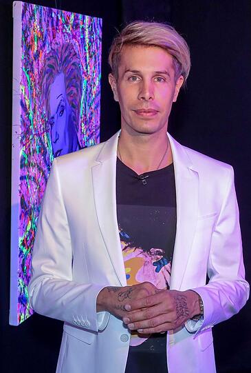 Ex-Dschungelcamper Florian Wess steht zu seinen Botox-Behandlungen.