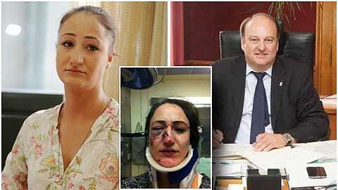 Nach der Verurteilung des Prügelpolizisten von der AU hat sich der neue Polizeipräsident beim Opfer Teresa Z. entschuldigt...