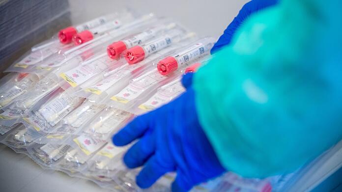 Testsets mit Abstrichstäbchen liegen in einem Testzentrum für Corona-Verdachtsfälle.